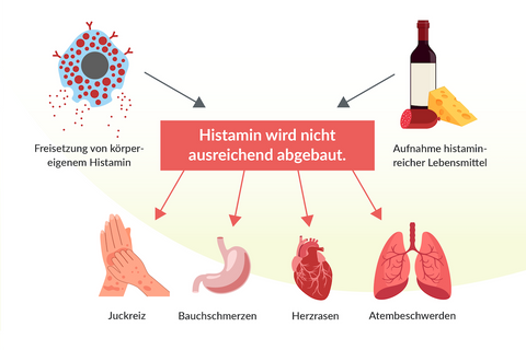 Infografik: Histaminunverträglichkeit