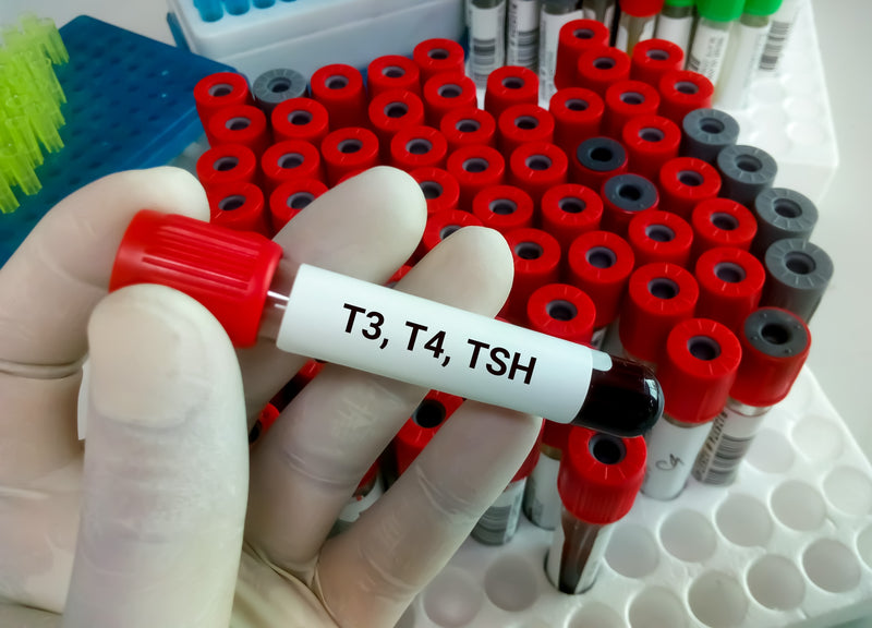 Schilddrüsenhormone: T3, T4, TSH in einer Blutprobe