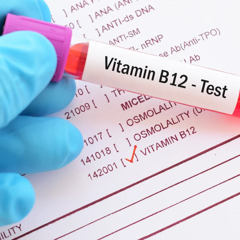 Vitamin b12 test