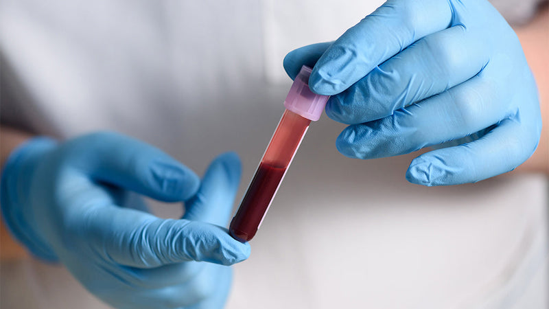Blutwerte verstehen: Person mit Gummihandschuhen hält Ampulle mit Blut in den Händen