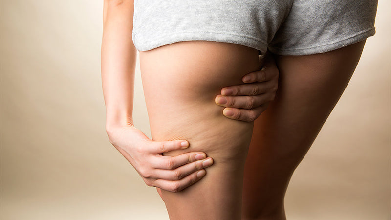 Cellulite bekämpfen: Was du gegen die Orangenhaut tun kannst