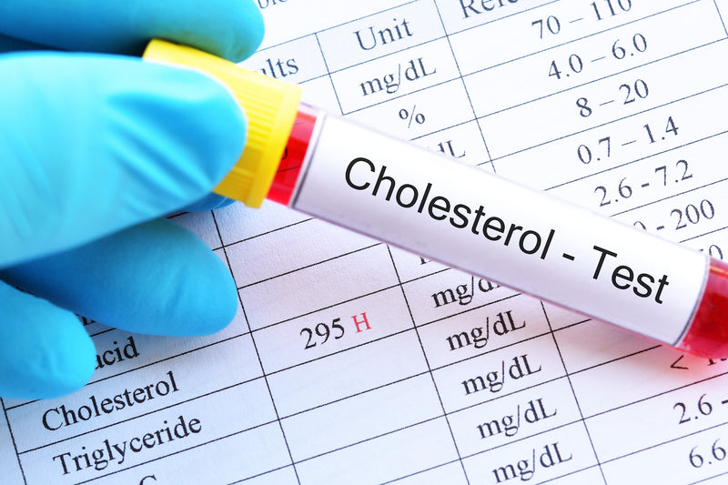 Cholesterin natürlich senken: Blutampulle mit der Aufschrift Cholesterol-Test