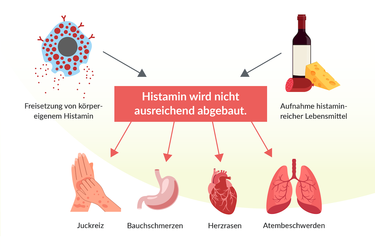 Infografik: Histaminunverträglichkeit