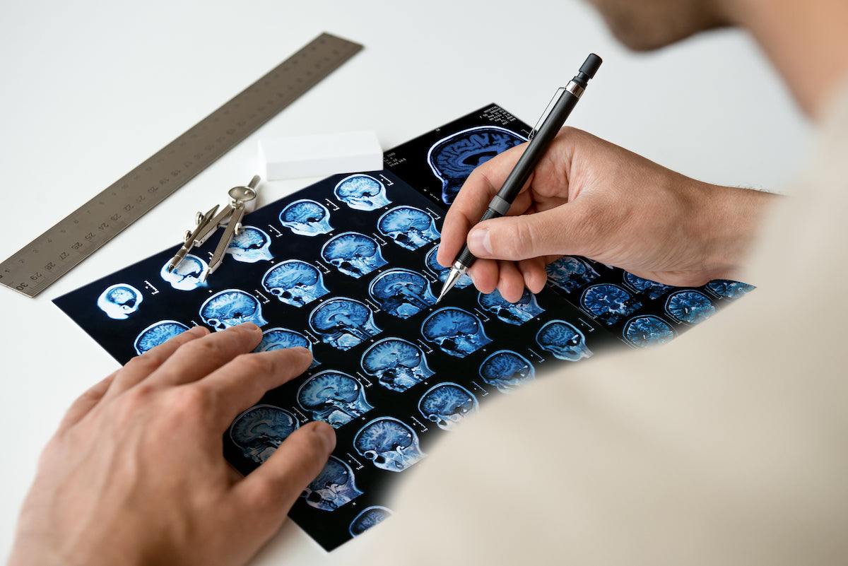 MRT-Bilder des Gehirns