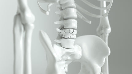 Knochenskelett-Modell: Osteoporose kann im Extremfall zu schlechterer Knochendichte und Calciummangel führen