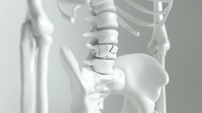 Knochenskelett-Model: Osteoporose kann im Extremfall zu schlechteren Knochendichte und Calciummangel führen