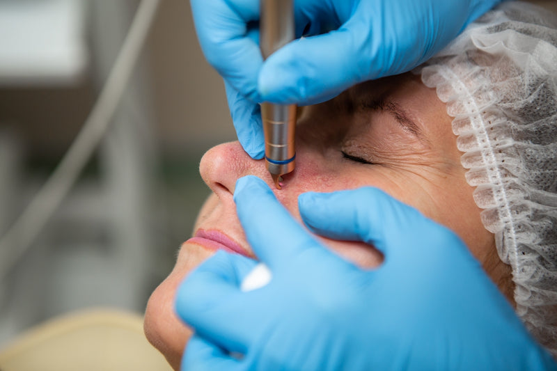 Patientin bei einer Laserbehandlung im Gesicht