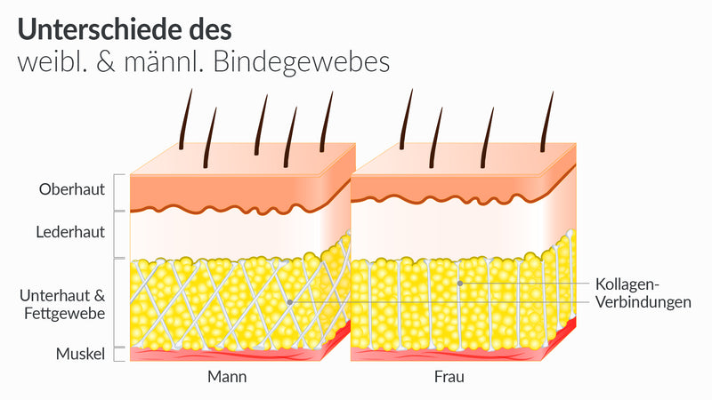 Eine Grafik, die erklärt, warum Cellulite eher bei Frauen entsteht, weil das Bindegewebe anders aufgebaut ist